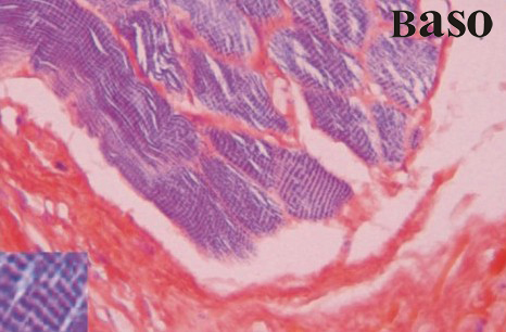 Phosphotungstic Acid Hematoxylin Stain